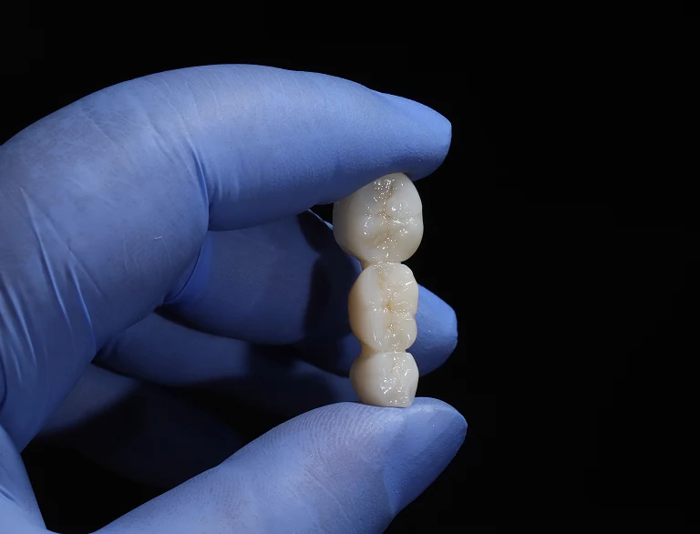 How Dental Bridges Work