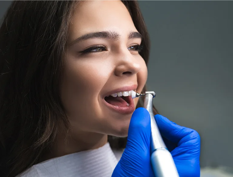 Professional Dental Cleanings